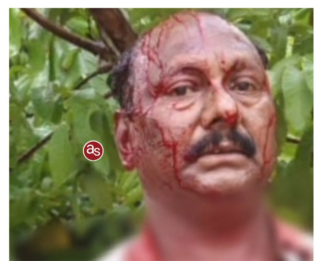 पेट्रोल पंप संचालक पर हमला, अज्ञात लोगों ने 6 लाख की लूट को दिया अंजाम .. Kshiti Technologies