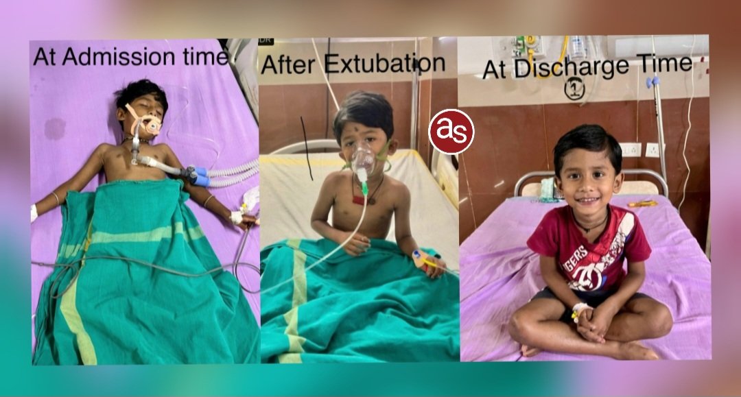 रायगढ़: करैत के डसने से मरणासन्न मासूम को मेडिकल कॉलेज हॉस्पिटल में मिला नया जीवन .. Kshiti Technologies रायगढ़: करैत के डसने से मरणासन्न मासूम को मेडिकल कॉलेज हॉस्पिटल में मिला नया जीवन .. Kshiti Technologies