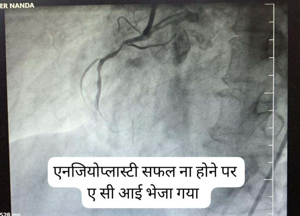 एसीआई ने एक बार फ़िर रचा नया इतिहास, कैथलैब में हुई लेजर कट एंजियोप्लास्टी का हुआ देशभर में जीवंत प्रसारण, राष्ट्रीय स्तर पर जुड़े कार्डियोलॉजिस्ट ने देखी प्रक्रिया .. Kshiti Technologies एसीआई ने एक बार फ़िर रचा नया इतिहास, कैथलैब में हुई लेजर कट एंजियोप्लास्टी का हुआ देशभर में जीवंत प्रसारण, राष्ट्रीय स्तर पर जुड़े कार्डियोलॉजिस्ट ने देखी प्रक्रिया .. Kshiti Technologies