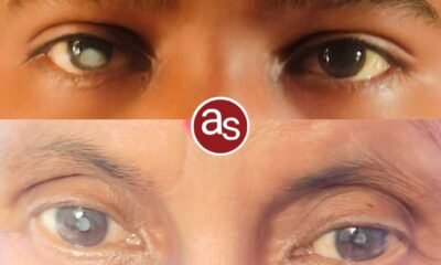 24 से 30 अक्टूबर तक चलेगा “सम्पूर्ण नेत्र सुरक्षा अभियान” .. Kshiti Technologies